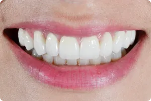Sorriso 1 — Studio Oral