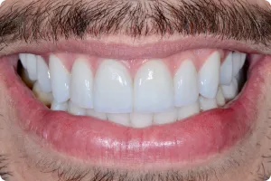 Sorriso 2 — Studio Oral