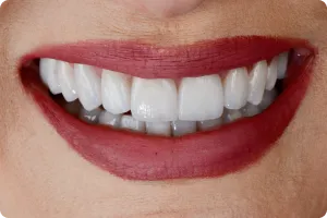 Sorriso 3 — Studio Oral