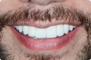 Sorriso 4 — Studio Oral