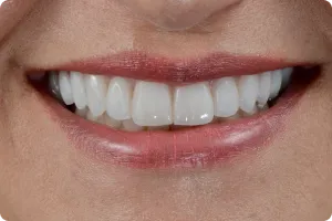 Sorriso 5 — Studio Oral