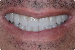 Sorriso 6 — Studio Oral
